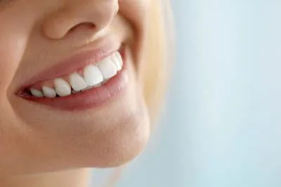 closeup of a woman's freshly whitened smile thanks to services from Gina Biedermann DDS in Keller, TX