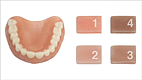 Lower denture model with four squares arranged in a 2x2 grid on a white background.
