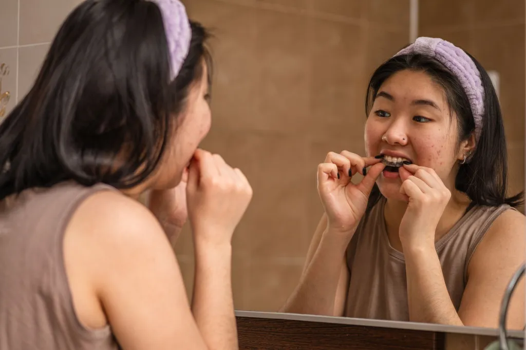 Woman prepares to insert clear aligners, examining her teeth in the mirror.