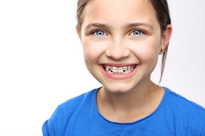 Smiling young girl with retainer braces, promoting healthy teeth and orthodontic care