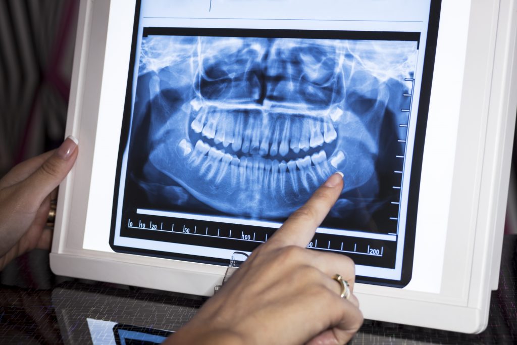 Close-up of hand holding digital tablet displaying dental X-ray