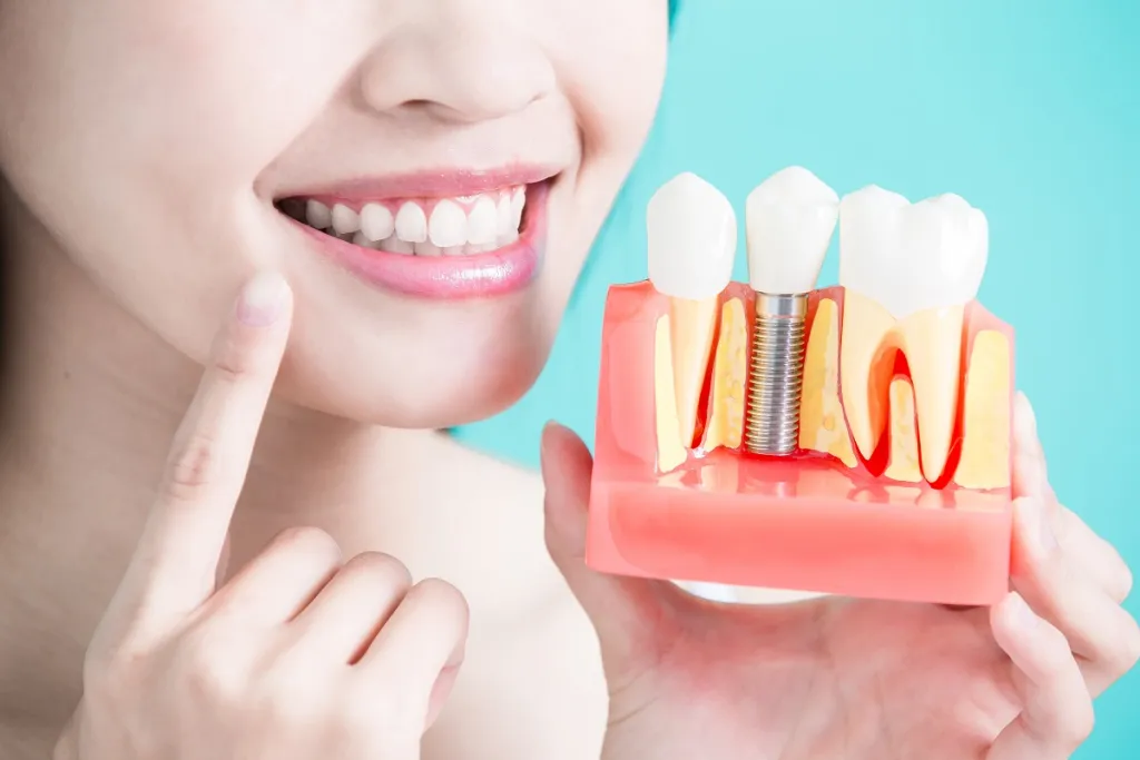 Close-up photo of young woman holding a clear dental model highlighting a dental implant