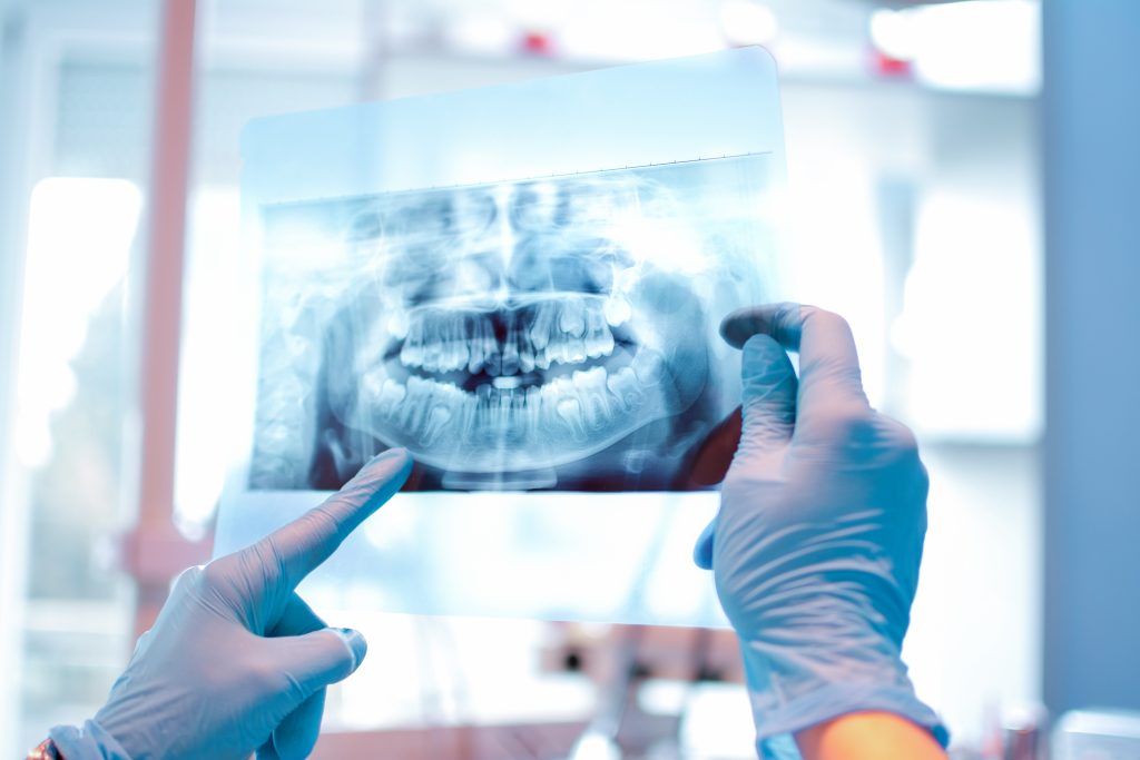Dental X-ray examination by dentist diagnosing tooth health.